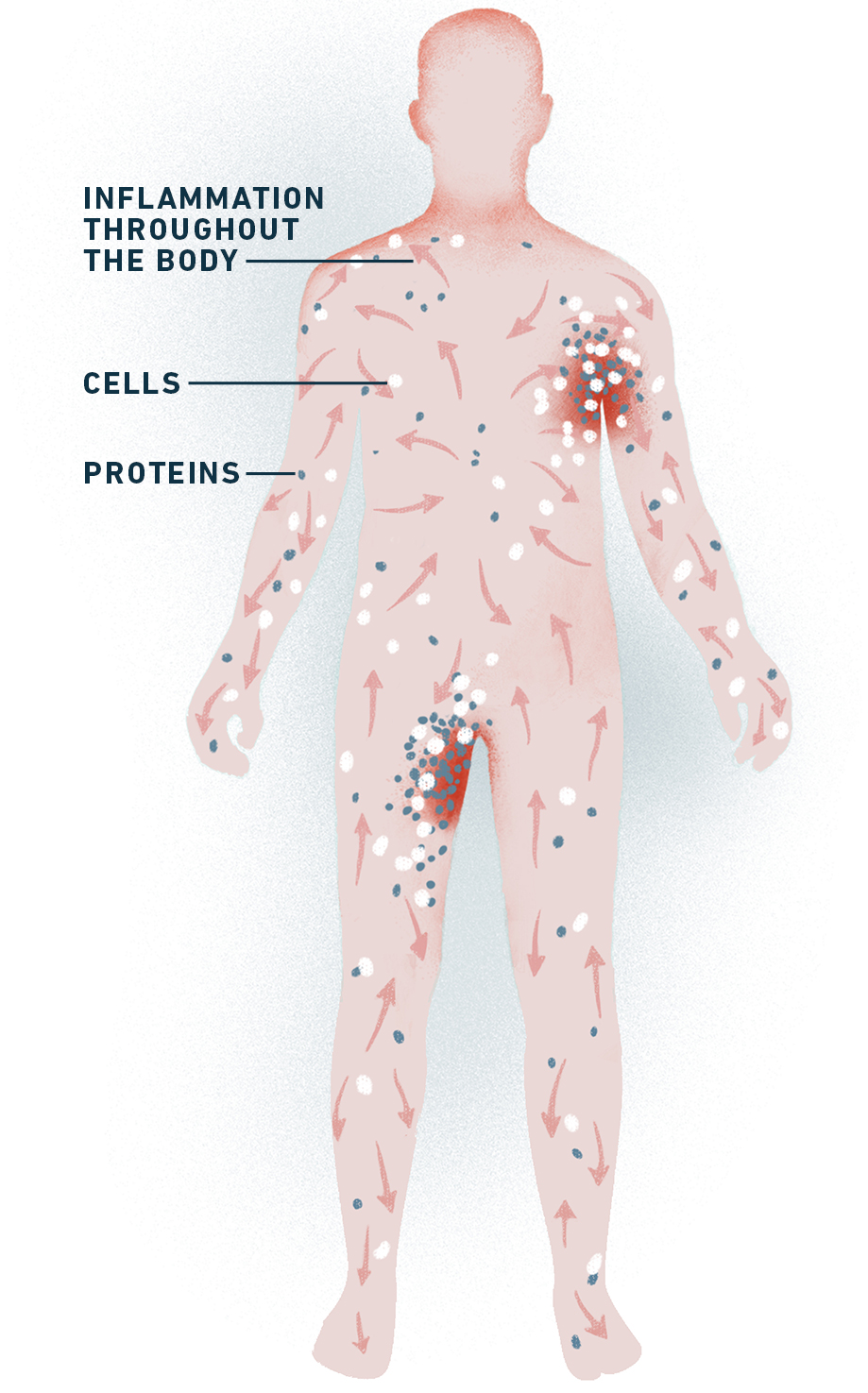 Diagram of a body showing inflammation throughout the body, cells, and proteins