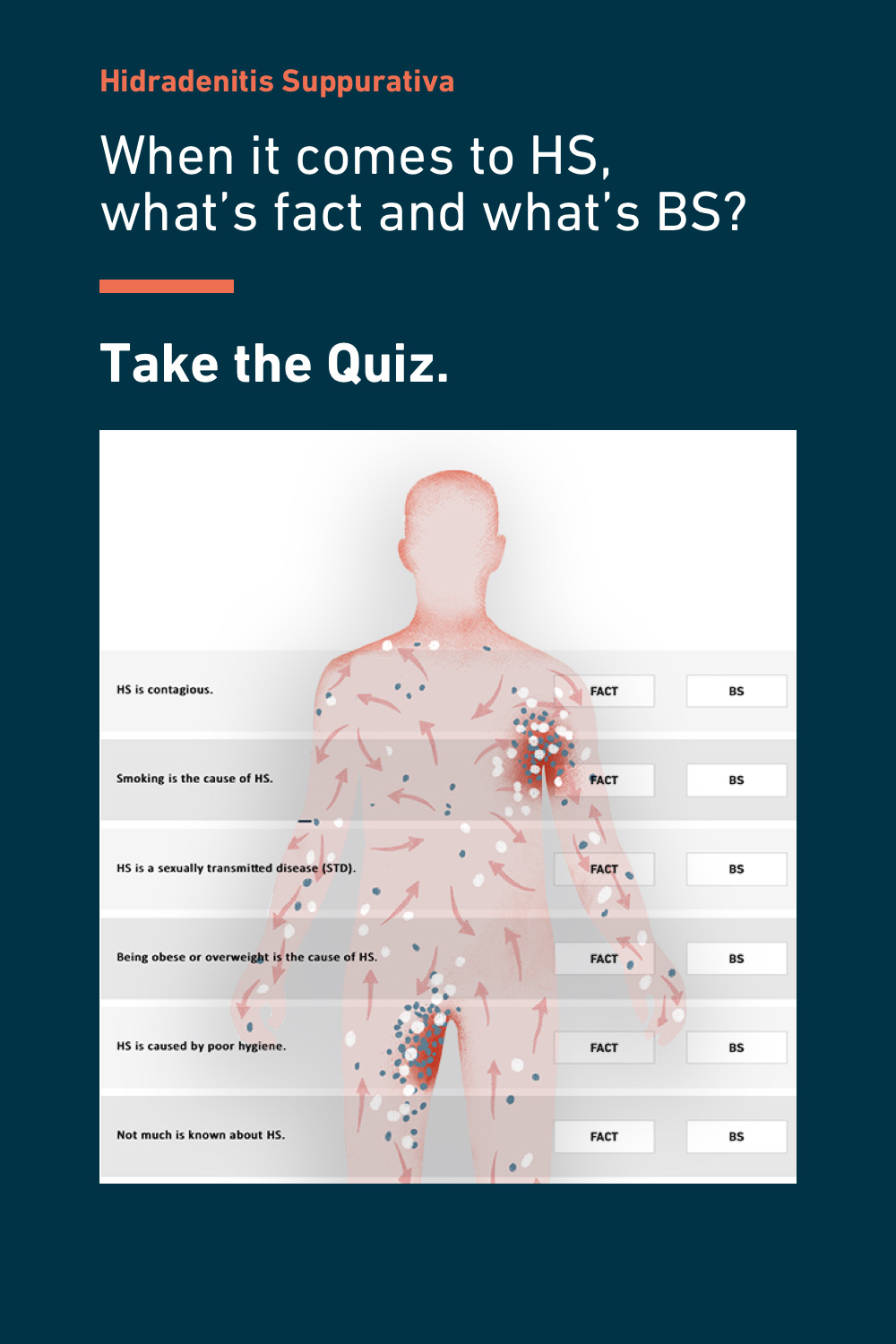 What is Hidradenitis Suppurativa (HS)?